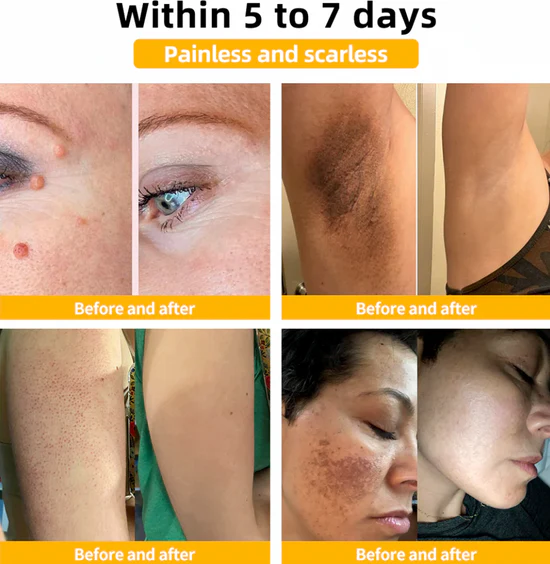 BeeVenom Skin Elixir|Radiant, Youthful, Hydrated Skin