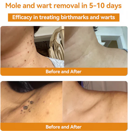 BeeVenom Skin Elixir|Radiant, Youthful, Hydrated Skin